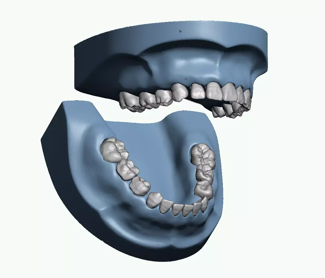 Primary teeth with pulp and base 3D print model