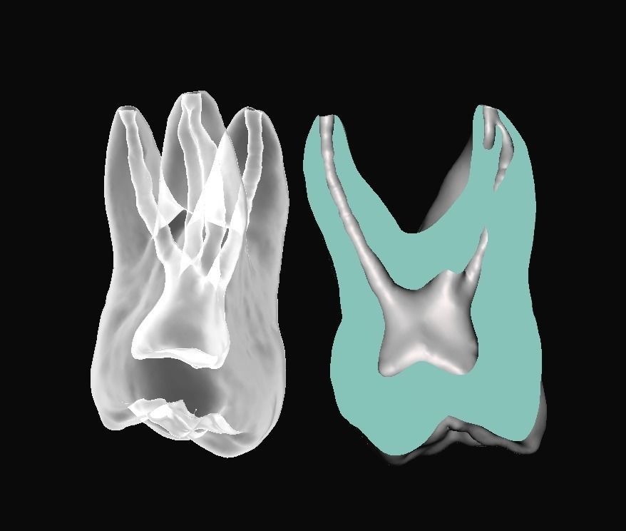 Natural teeth anatomy with root canal and solid pulp set 3D print model_10
