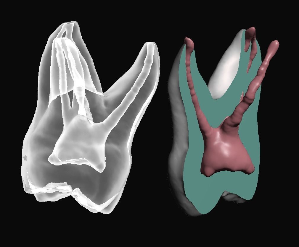 Natural teeth anatomy with root canal and solid pulp set 3D print model_4