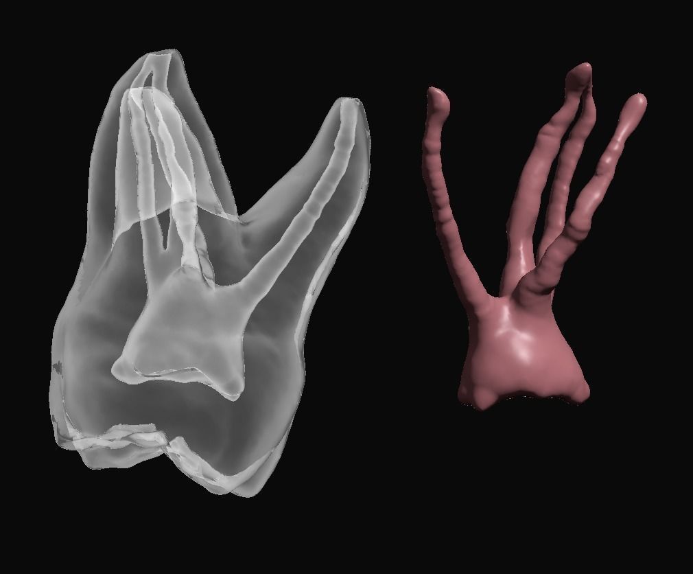 Natural teeth anatomy with root canal and solid pulp set 3D print model_5