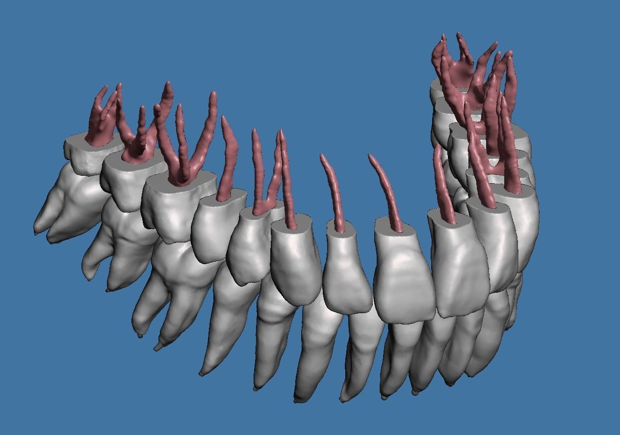 Natural teeth anatomy with root canal and solid pulp set 3D print model_3