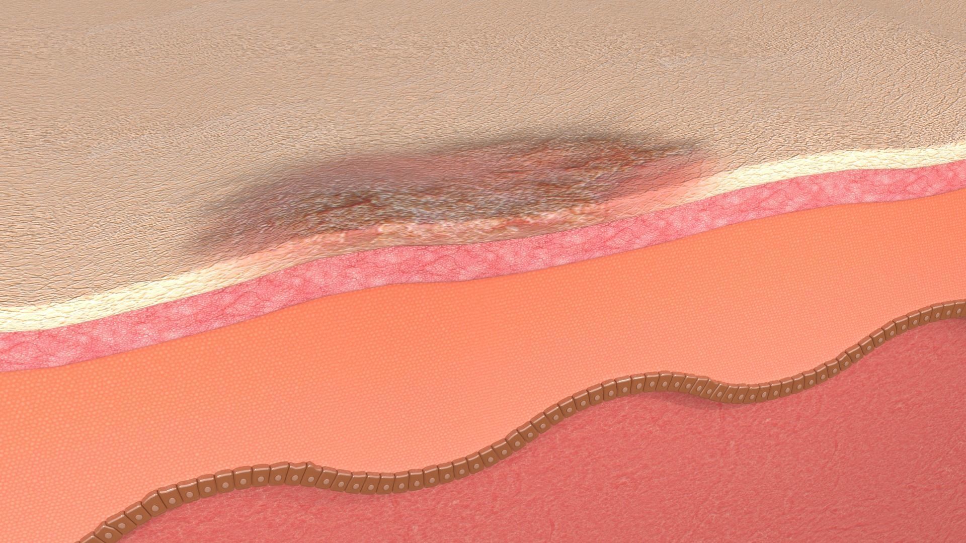 Simple Skin layer Healthy 3D model 3D model_2