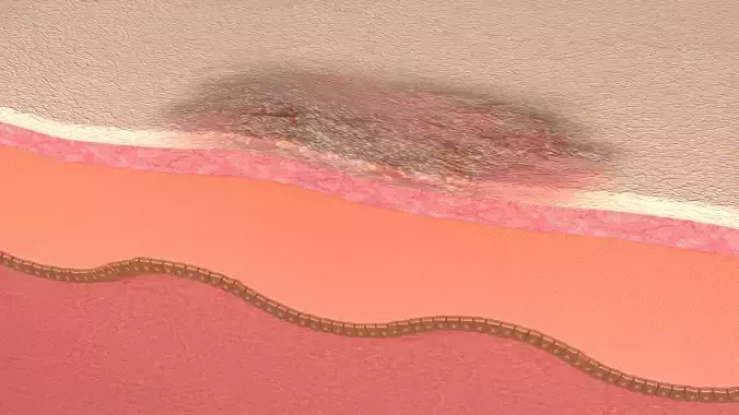 Simple Skin layer Healthy 3D model