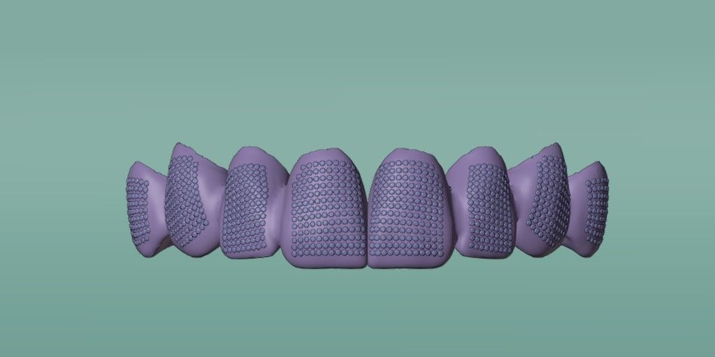 Grillz with diamonds 3D model_4