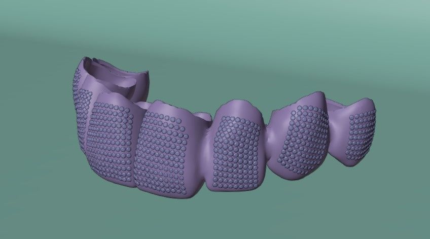Grillz with diamonds 3D model_5