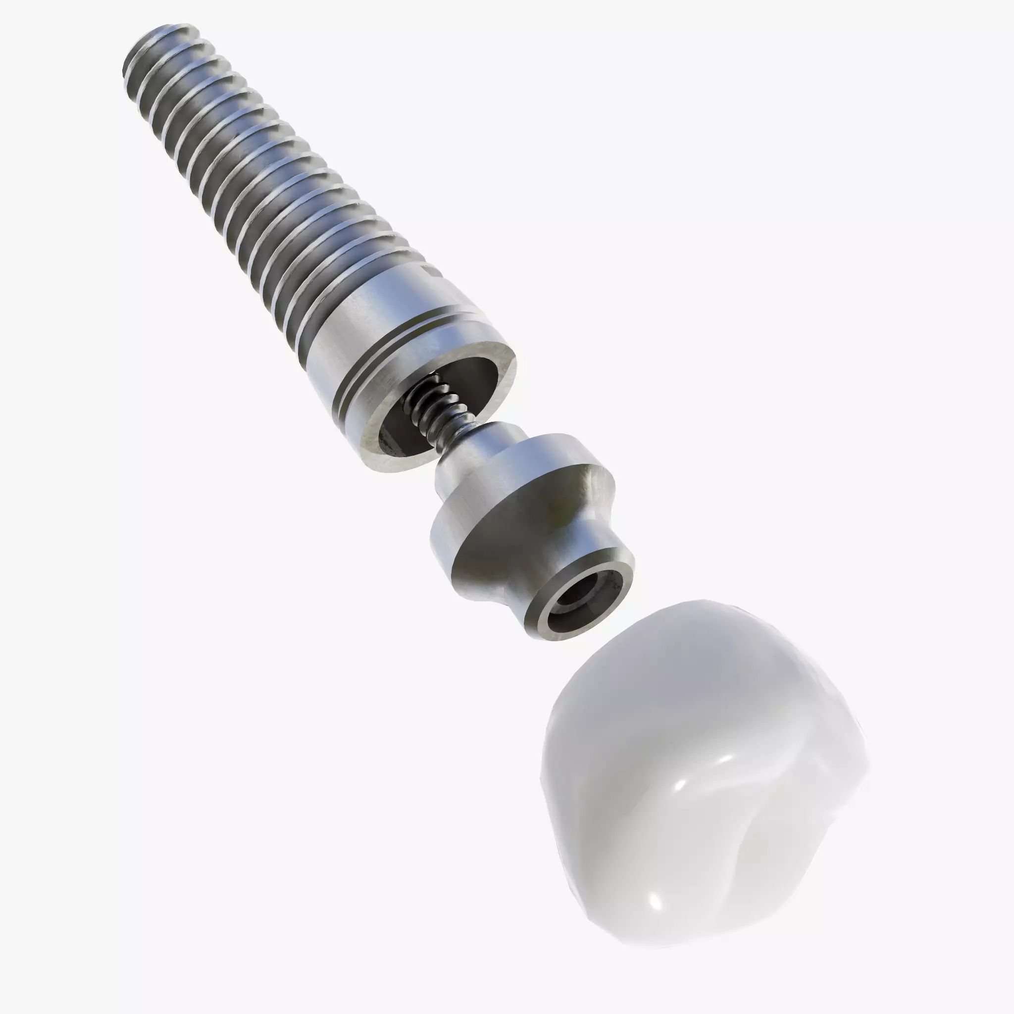 Dental Implant Low-poly 3D model