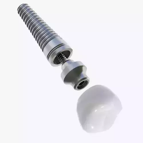 Dental Implant Low-poly 3D model