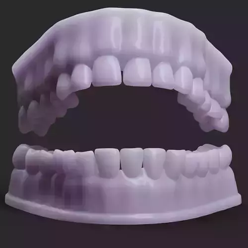 Dentures D Mold