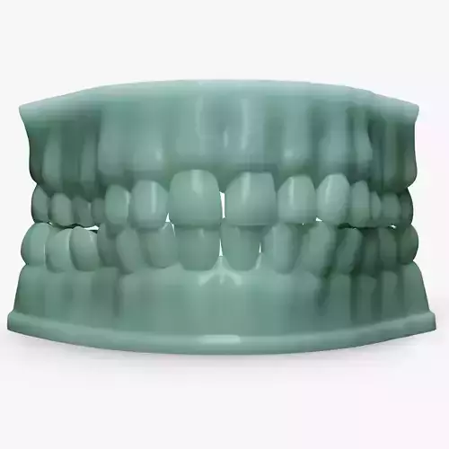 Dentures D Mold