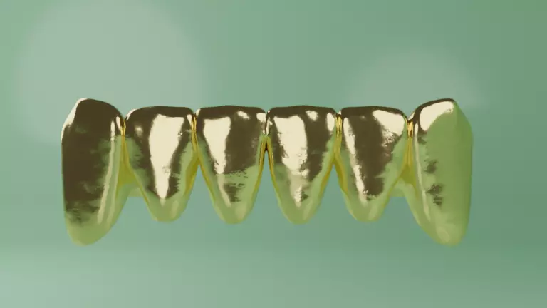 Lower Grillz - gold teeth 3D model