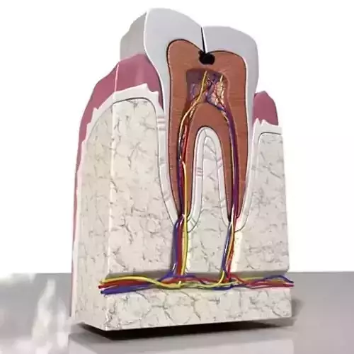 Cracked Tooth High Detail