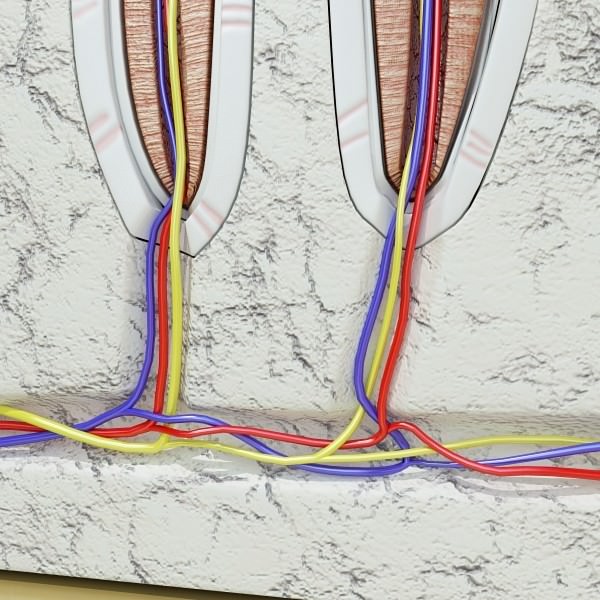 Teeth Pathologies High Detail 3D model_12