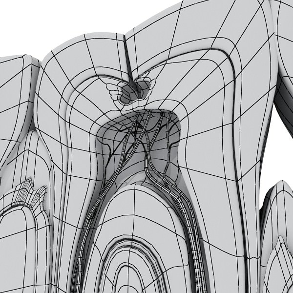 Teeth Pathologies High Detail 3D model_16