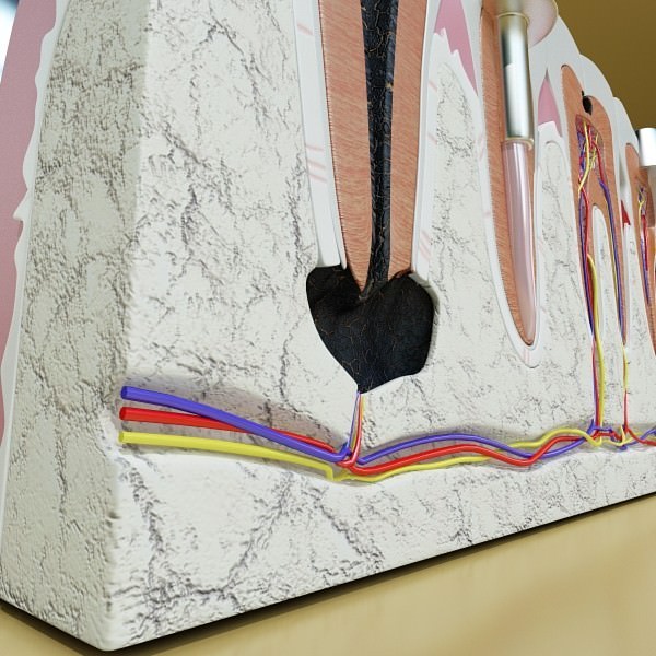 Teeth Pathologies High Detail 3D model_10