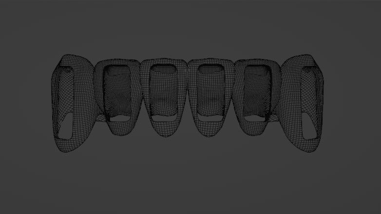 Lower Grillz - gold teeth 3D model 3D model_6