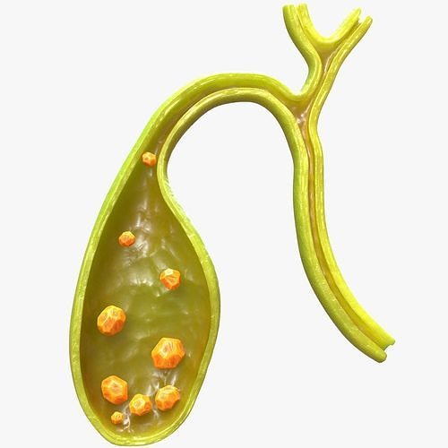 Gallbladder with Gallstones 3D model