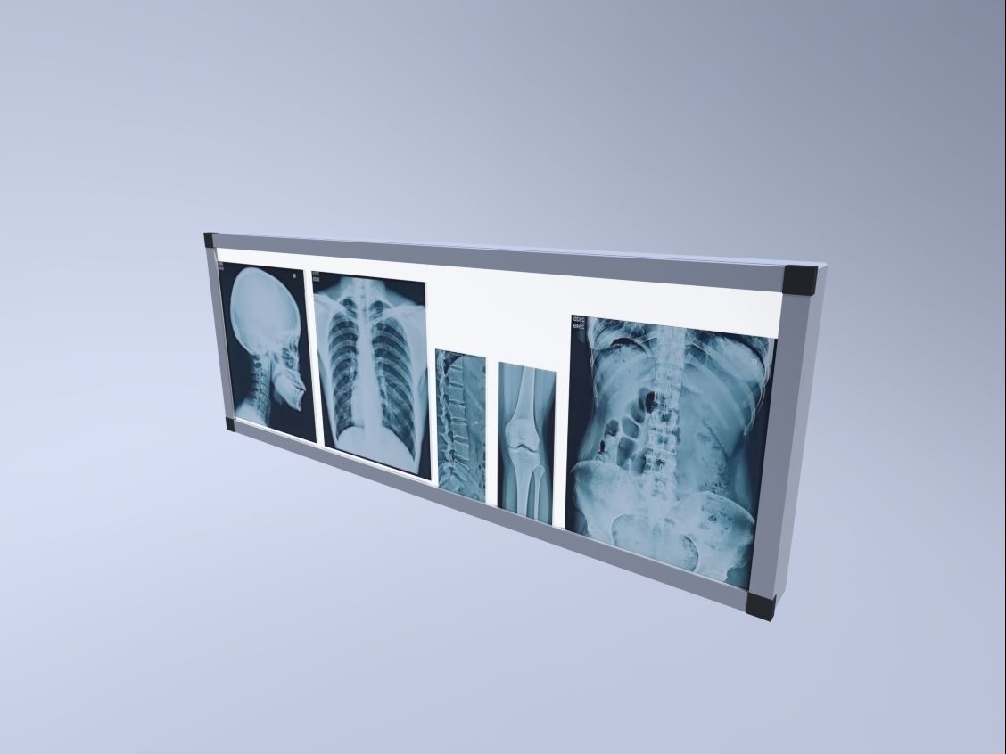 Negatoscope 3D model_0