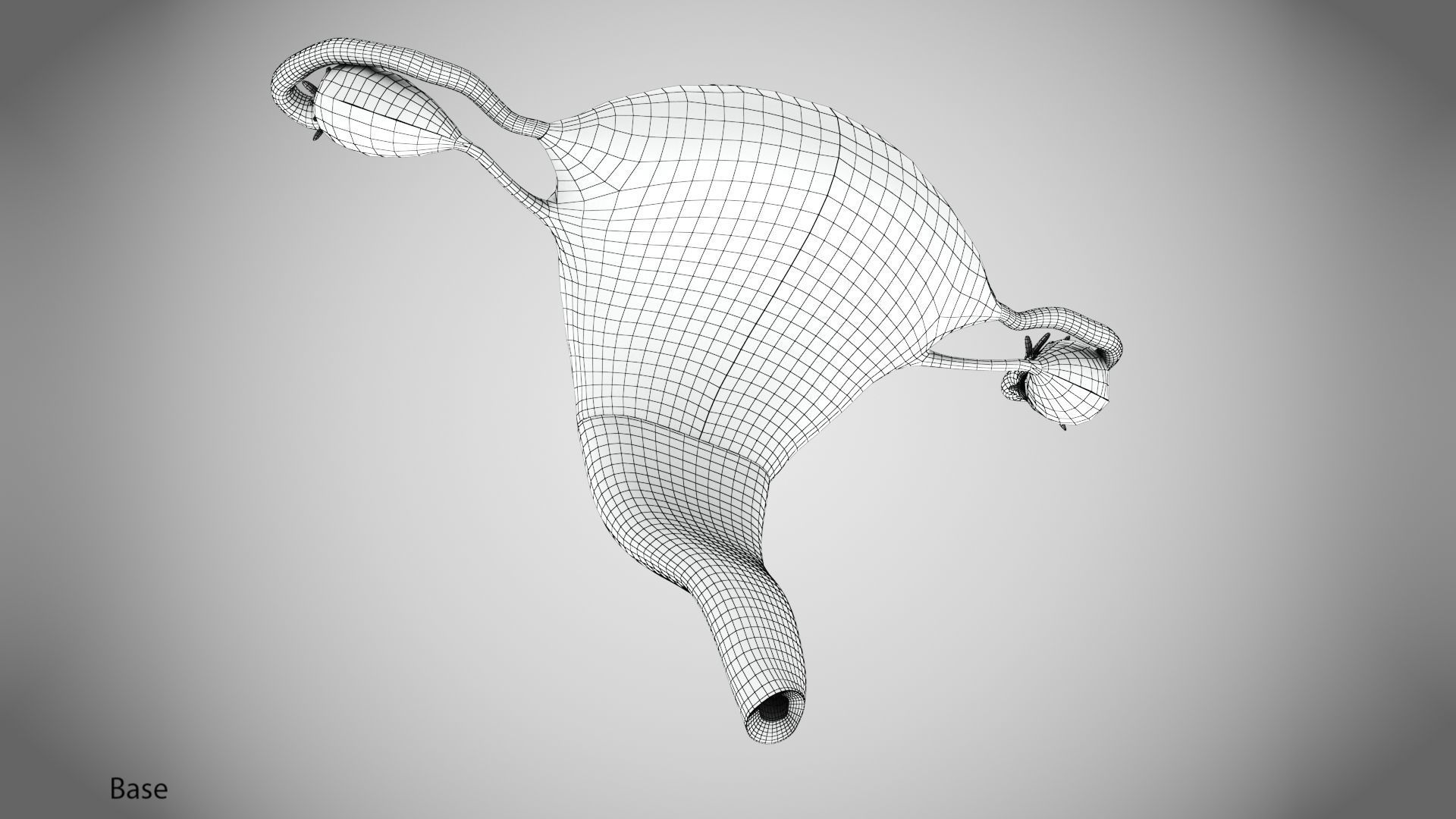 Uterus with Anatomic-Cut 3D model_13