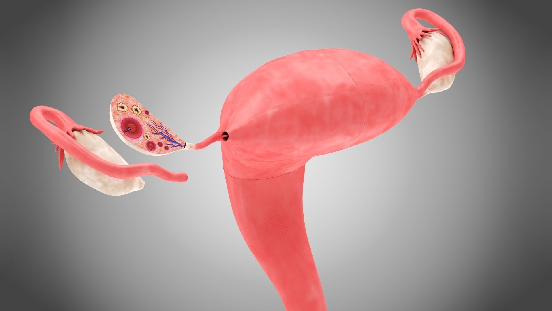 Uterus with Anatomic-Cut 3D model_3