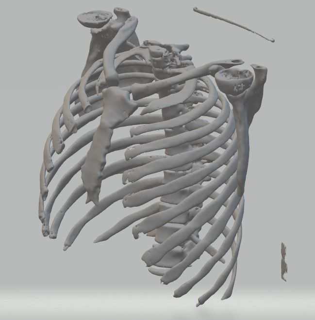 Anatomy Human Rib Cage  3D print model_1