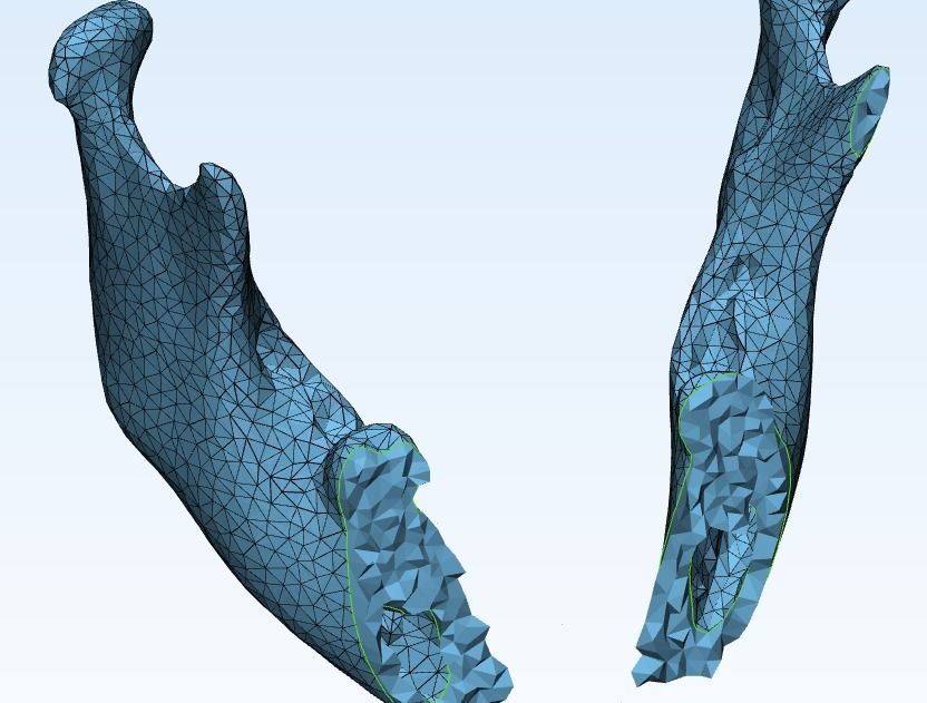 mandible human jaw Free 3D model_5