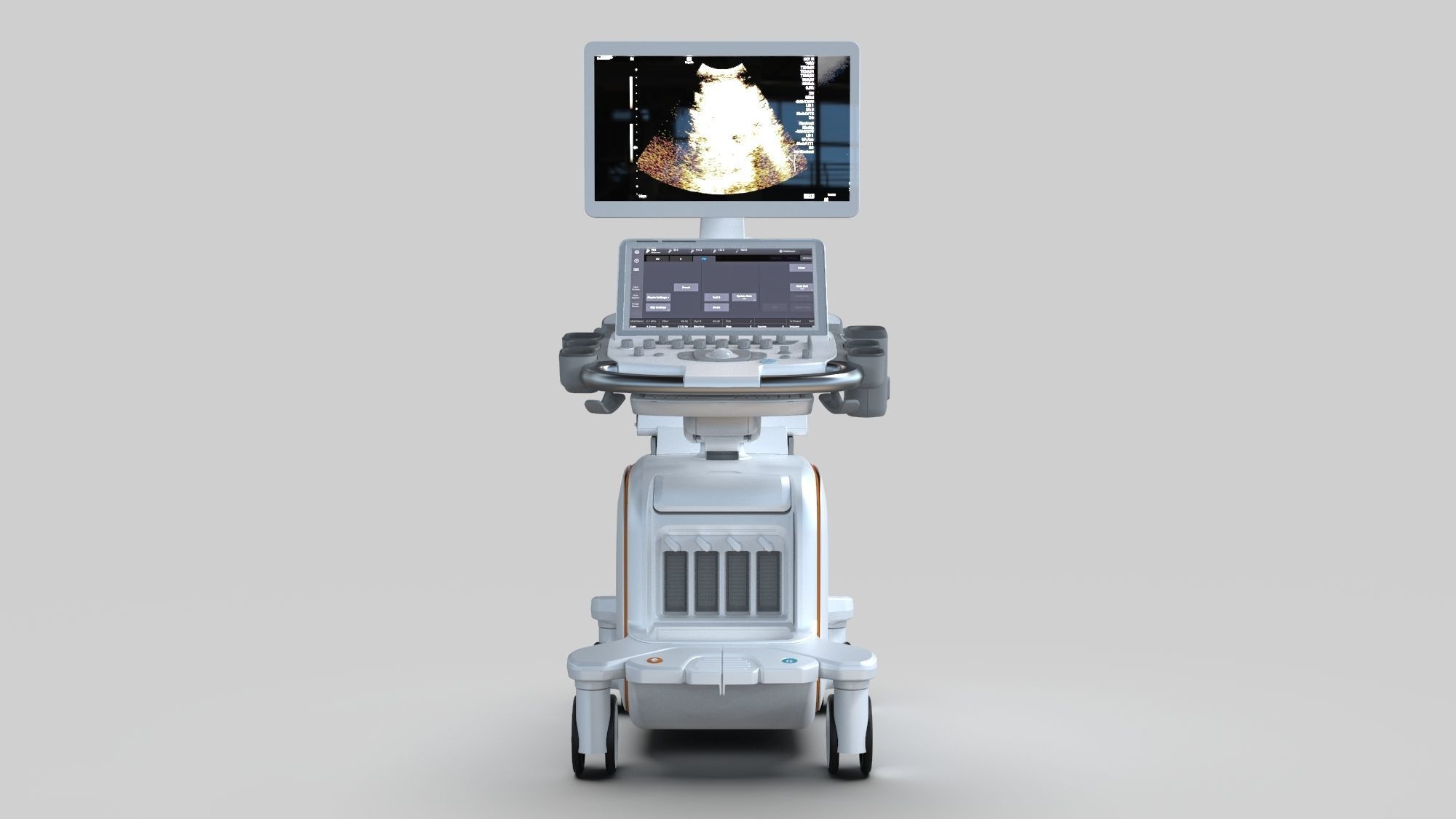 Siemens healthineers Acuson sequoia 3D model_1