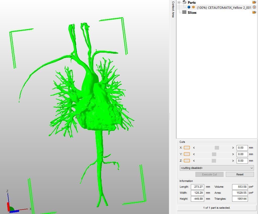 Human Aorta with Heart Chambers 3D print model_5