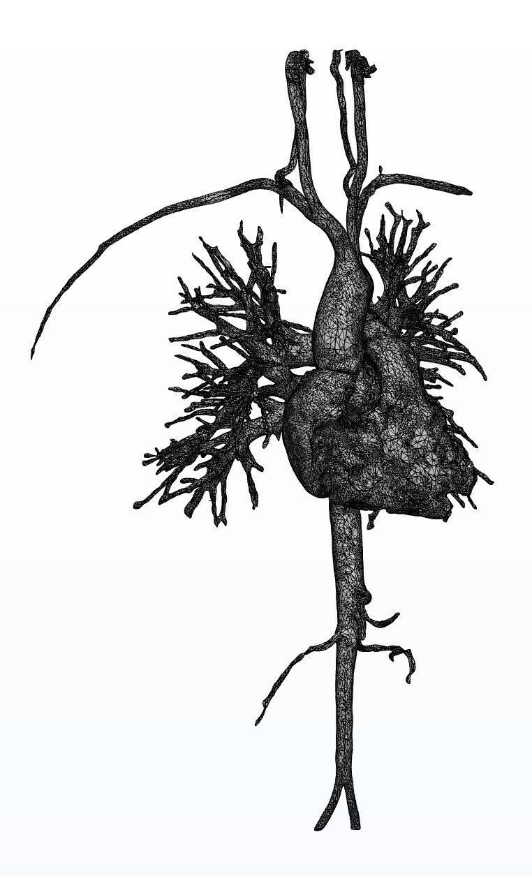 Human Aorta with Heart Chambers 3D print model_6