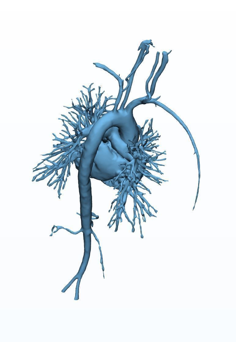 Human Aorta with Heart Chambers 3D print model_3