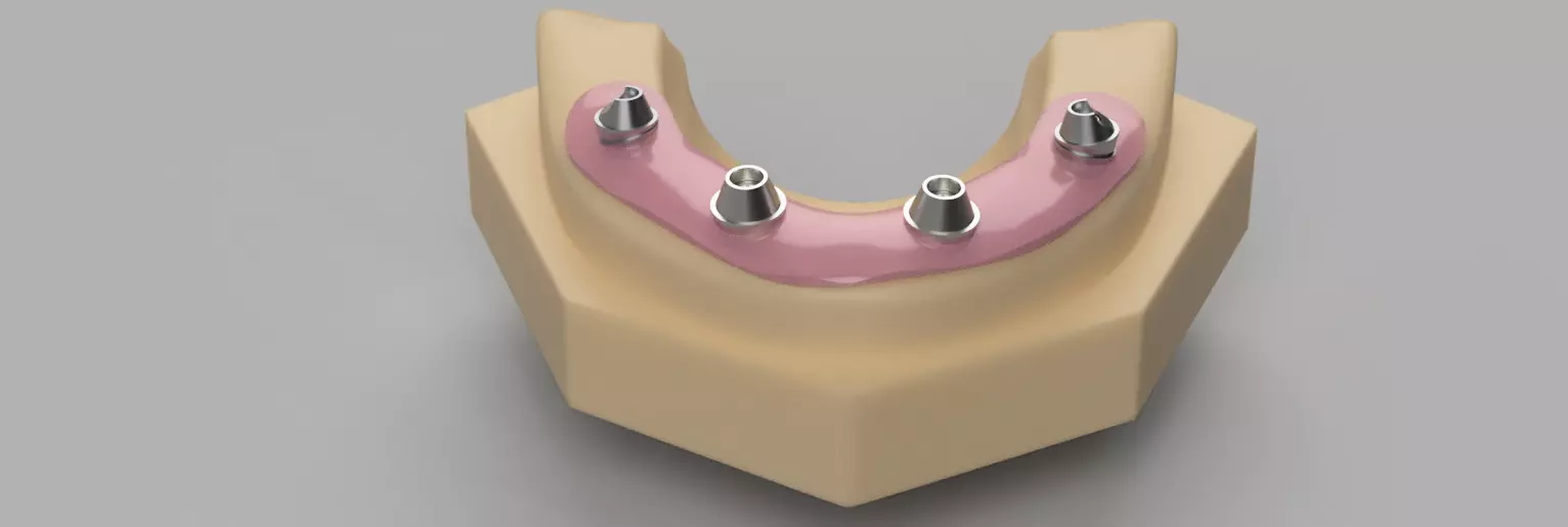 SCREW RETAINED ABUTMENTS 3D model_0