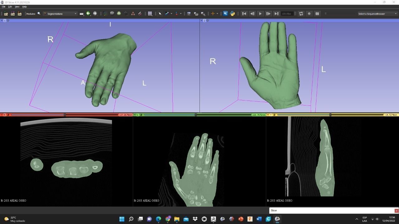 Left hand 3D print model_4