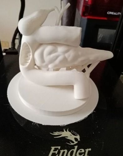 Duodenum and pancreas  3D print model_2