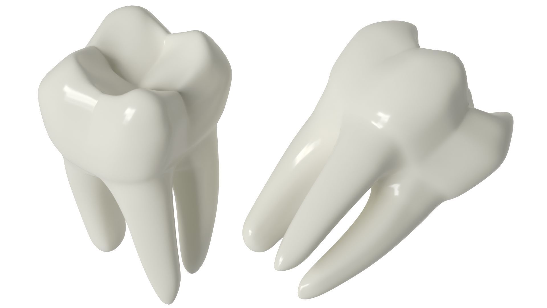Tooth decay stages cavity caries 3D model_3