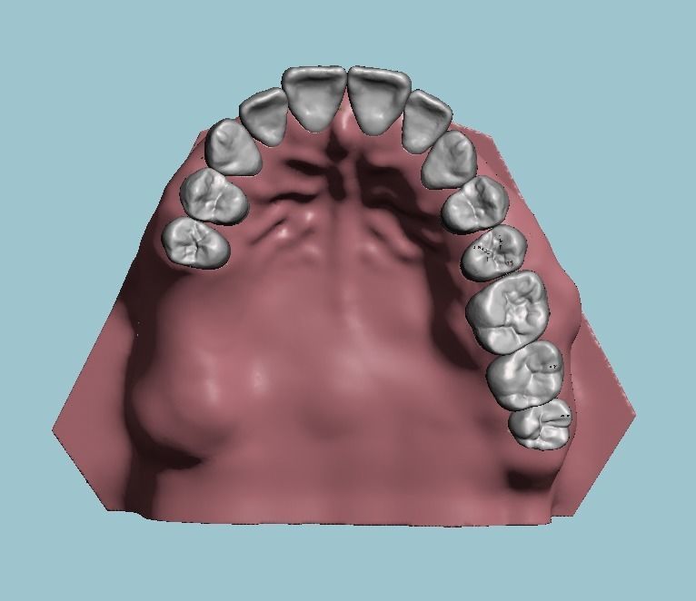 D011 Oral surgery and perio model 3D print model_15