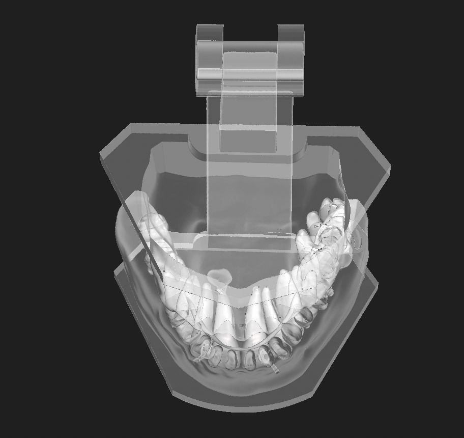 D011 Oral surgery and perio model 3D print model_19