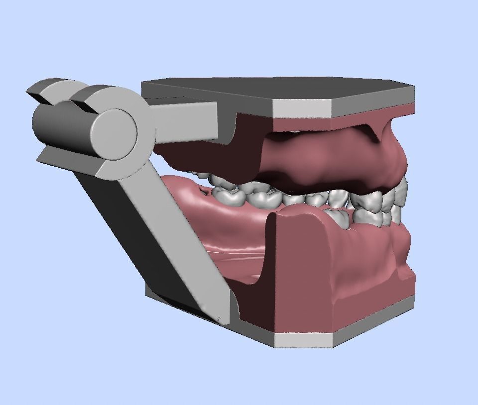 D011 Oral surgery and perio model 3D print model_4