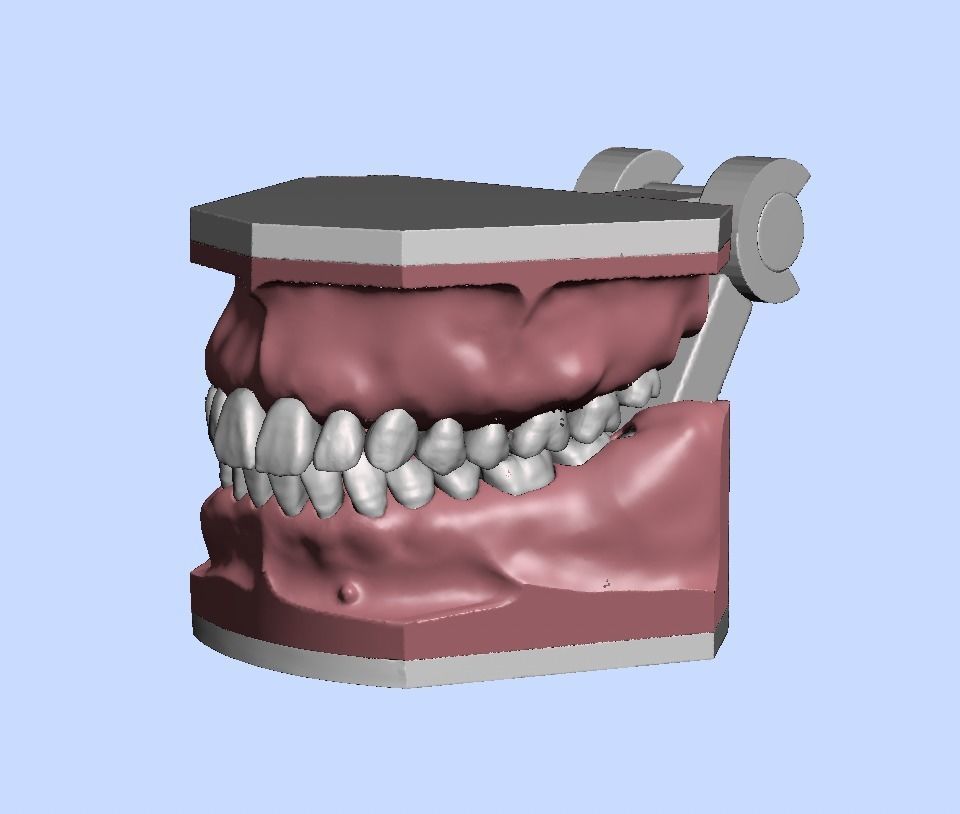 D011 Oral surgery and perio model 3D print model_2