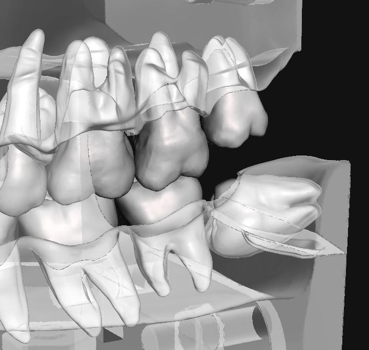 D011 Oral surgery and perio model 3D print model_8
