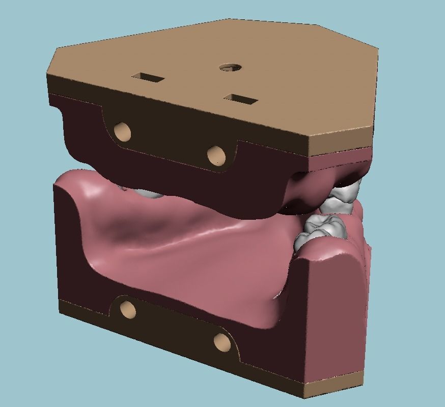 D011 Oral surgery and perio model 3D print model_14