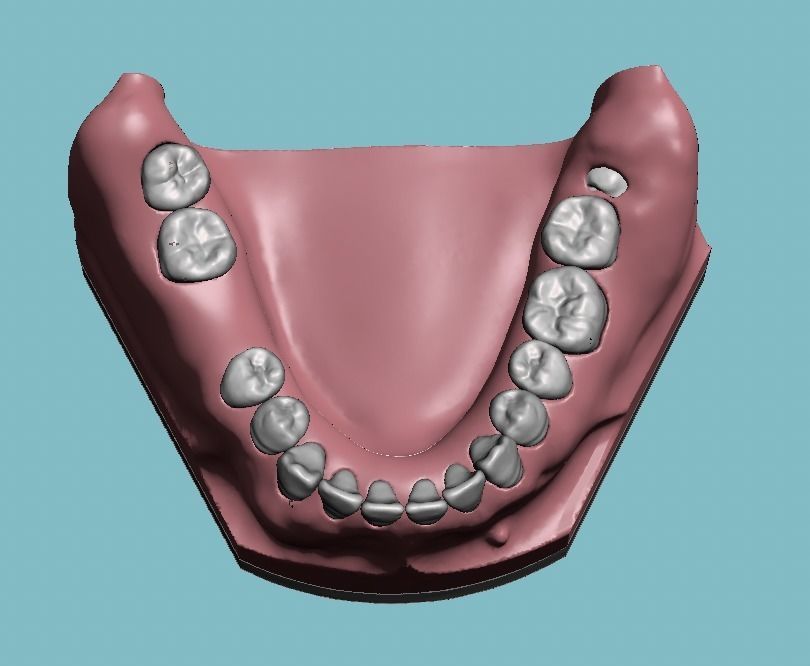 D011 Oral surgery and perio model 3D print model_16