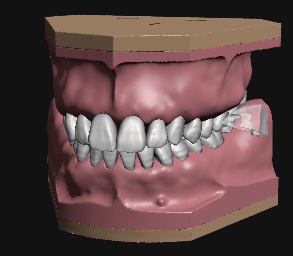 D011 Oral surgery and perio model 3D print model_12