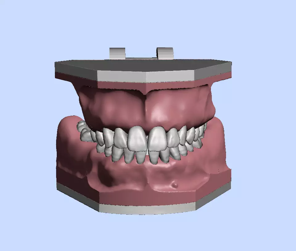 D011 Oral surgery and perio model 3D print model_0