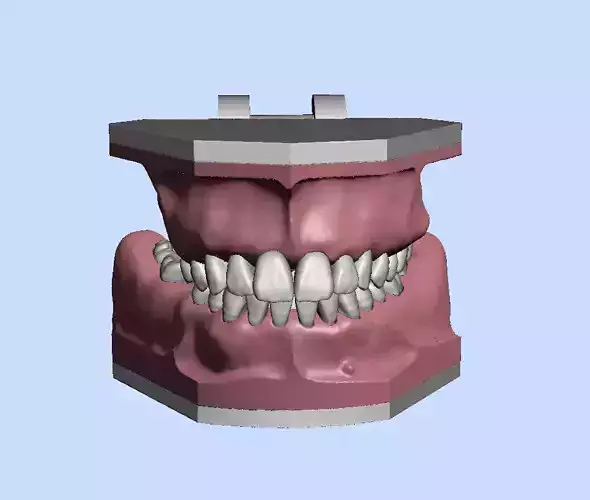 D011 Oral surgery and perio model  3D print model