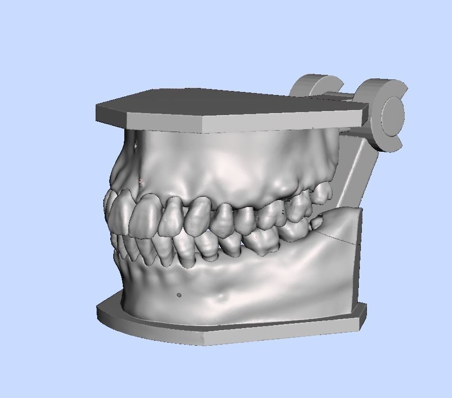 D011 Oral surgery and perio model 3D print model_5