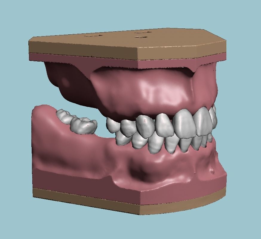 D011 Oral surgery and perio model 3D print model_13