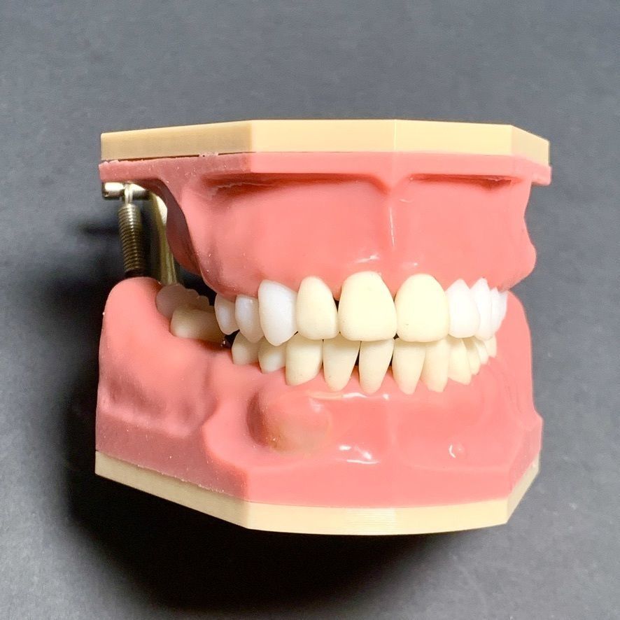 D011 Oral surgery and perio model 3D print model_22