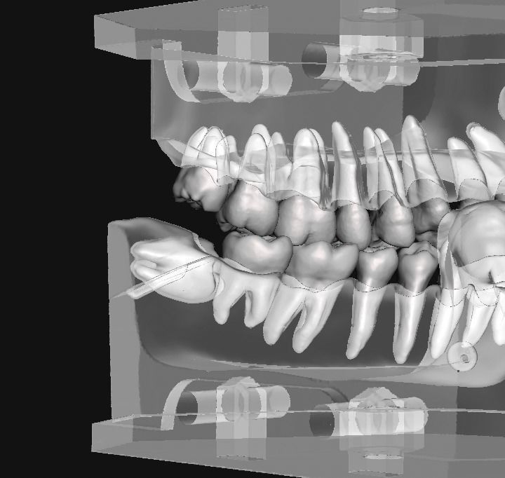 D011 Oral surgery and perio model 3D print model_6
