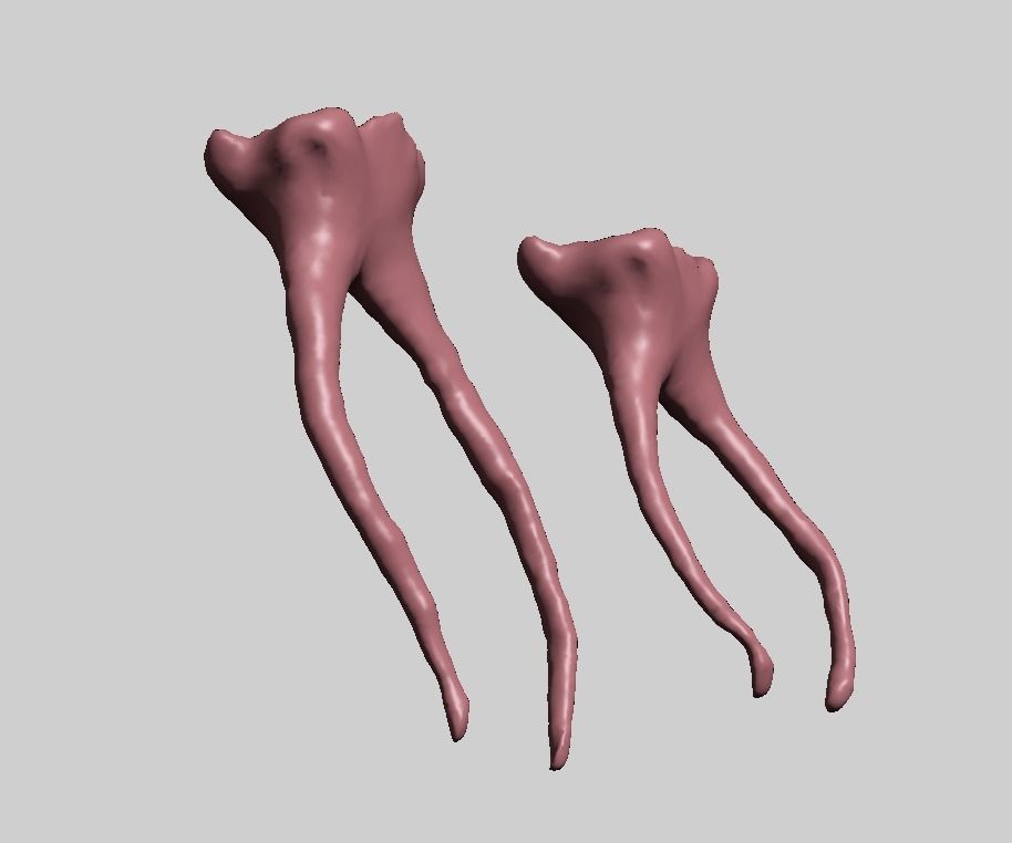 D009 Teeth anatomy 2 piece and solid pulp data for editing  3D print model_5