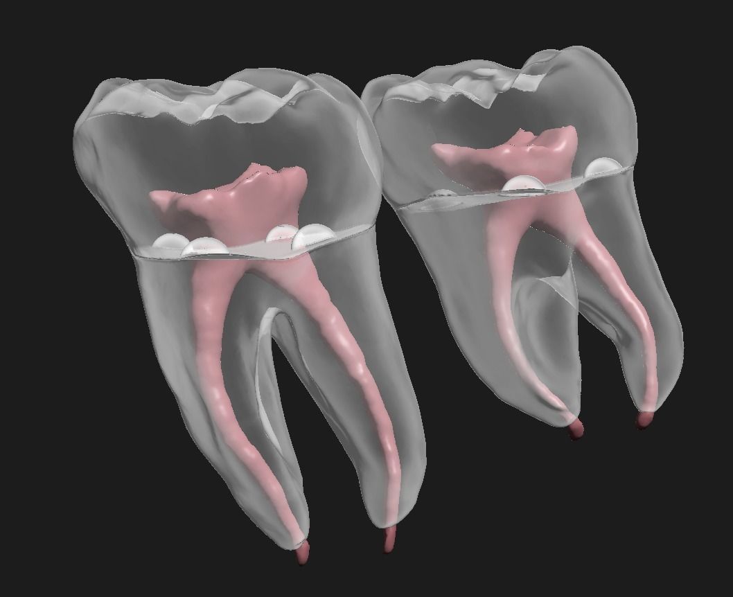 D009 Teeth anatomy 2 piece and solid pulp data for editing  3D print model_9