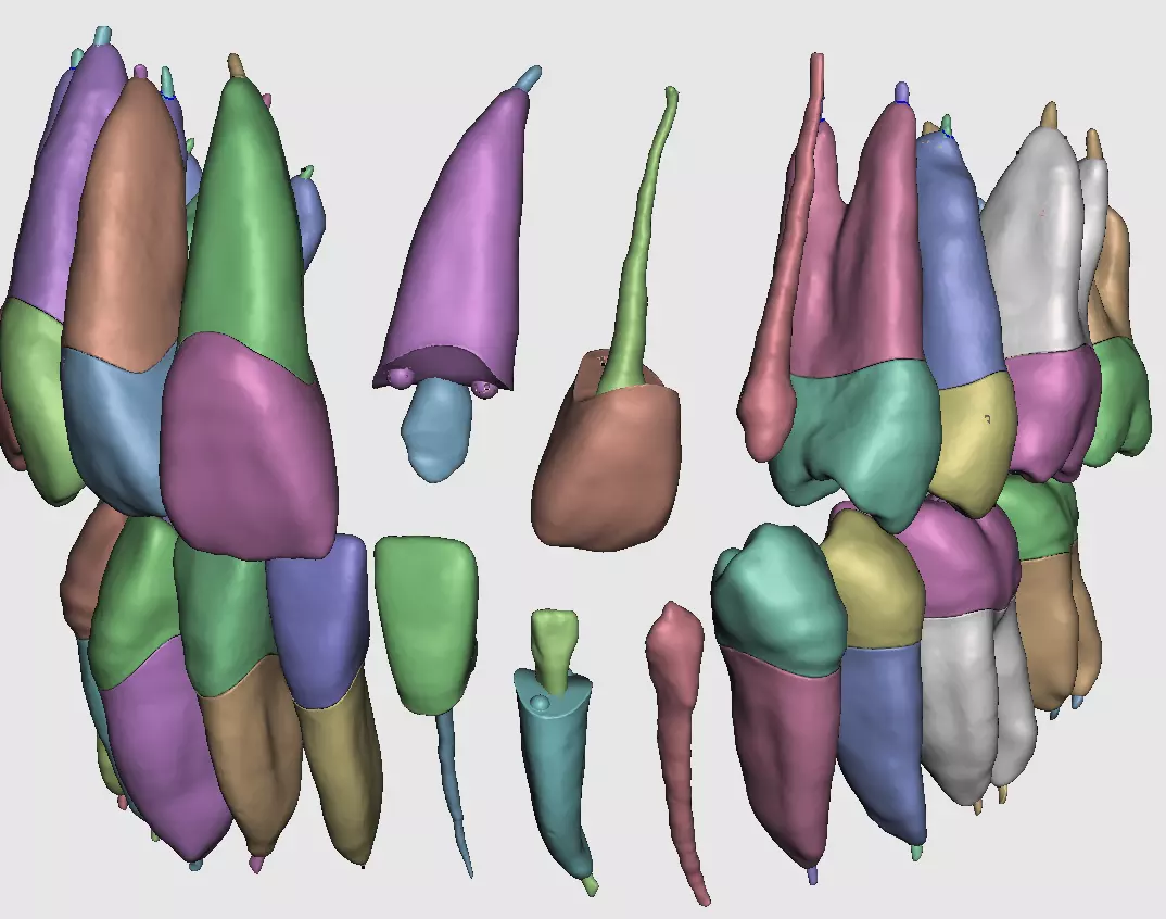 D009 Teeth anatomy 2 piece and solid pulp data for editing  3D print model_0